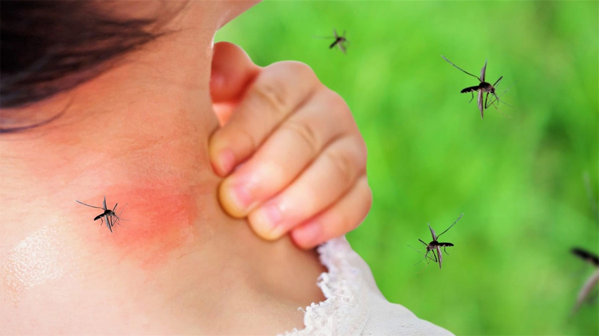 حمى الضنك تعرف على أعراضها وكيفية علاجها موقع محتويات