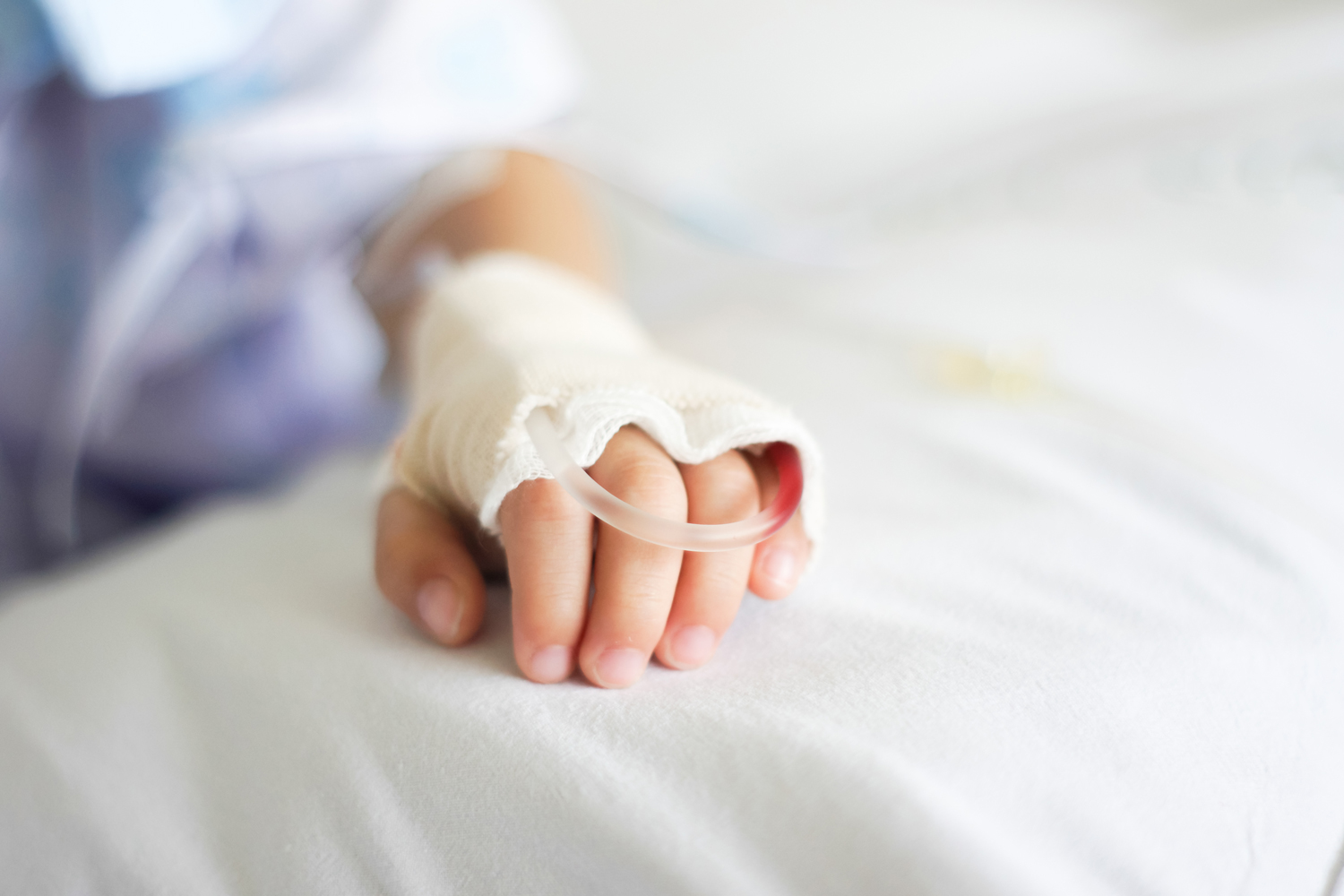 مرض التفول للأطفال : أعراضه وكيفية تشخيصه ومضاعفاته وعلاجه