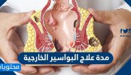 مدة علاج البواسير الخارجية