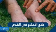 علاج الأملاح في القدم .. كيف تعلم انك مصاب بتراكم الاملاح