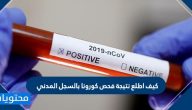 كيف اطلع نتيجة فحص كورونا بالسجل المدني