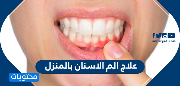 علاج الم الاسنان بالمنزل