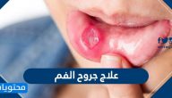 علاج جروح الفم … وأسباب الإصابة بها وطرق الوقاية منها