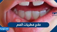 علاج فطريات الفم … الطبية والمنزلية وأسباب الإصابة بها وأعراضها