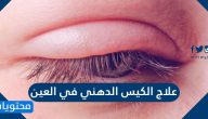 علاج الكيس الدهني في العين .. أسباب وجود كيس دهني في العين 