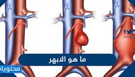 ما هو الابهر .. الحالات المرضية التي تصيب الأبهر