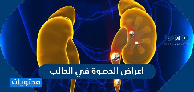 أعراض حصوات المرارة في الحالب وتنظيف الكلى من الرمل ومحتويات الموقع