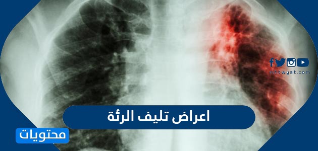 اعراض تليف الرئة واهم طرق علاجه موقع محتويات