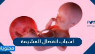 اسباب انفصال المشيمة .. أهم الاعراض والعلامات لانفصال المشيمة