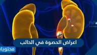 اعراض الحصوة في الحالب … تنظيف الكلى من الرمل