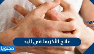 علاج الأكزيما في اليد .. علاج الأكزيما بالأعشاب