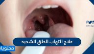 علاج التهاب الحلق الشديد .. حالات تستدعي زيارة الطبيب