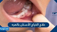 علاج الخراج الأسنان بالمره واهم طرق الوقاية منه