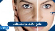 علاج الكلف والتصبغات … 3 خلطات للكلف والتصبغات