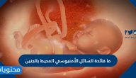 ما فائدة السائل الأمنيوسي المحيط بالجنين .. 8 فوائد يقدمها السائل الميوسي للجنين