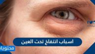 اسباب انتفاخ تحت العين عند الاستيقاظ من النوم وأفضل الطرق لعلاجه