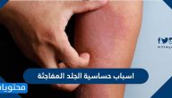 اسباب حساسية الجلد المفاجئة