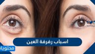 اسباب رفرفة العين … 22 سبب لارتعاش الجفون وطرق علاجها