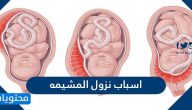 اسباب نزول المشيمة ونصائح لتجنب حدوثها