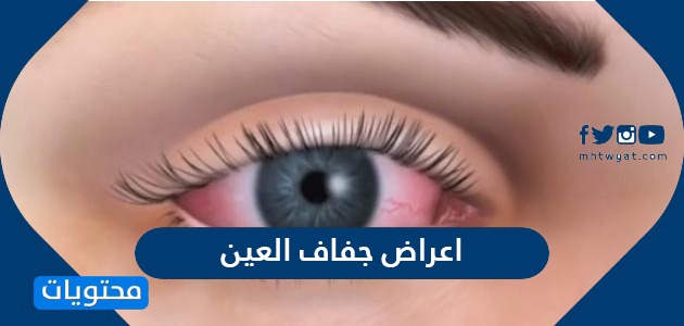 اعراض جفاف العين واسبابها وطرق علاجها بالتفصيل