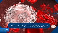 تنتج في مرض اللوكيميا سرطان الدم باعداد هائله