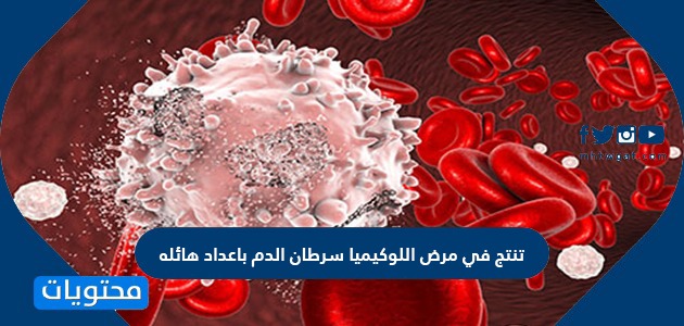 تنتج في مرض اللوكيميا سرطان الدم باعداد هائله