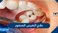 علاج الضرس المحفور بالتفصيل