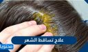 علاج تساقط الشعر بالطرق المنزلية والطبية المختلفة