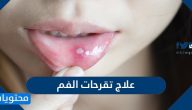 علاج تقرحات الفم بالطرق المنزلية والدوائية