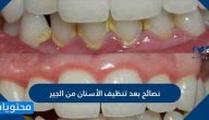 نصائح بعد تنظيف الاسنان من الجير