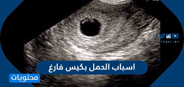 اسباب الحمل بكيس فارغ واعراضه وطرق تشخيصه وعلاجه