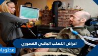 اعراض التصلب الجانبي الضموري وأسبابه وطرق علاجه