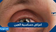 اعراض حساسية العين واسبابها وطرق علاجها والوقاية من حدوثها