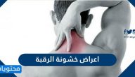 اعراض خشونة الرقبة وطرق علاجها بالطرق الطبية والمنزلية