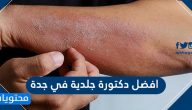 افضل دكتورة جلدية في جدة 2025