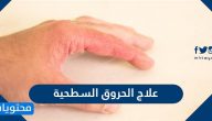 علاج الحروق السطحية بالوصفات الطبيعية