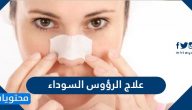 علاج الرؤوس السوداء في الوجه نهائيا