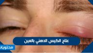 علاج الكيس الدهني بالعين بالطرق المنزلية والدوائية والجراحية