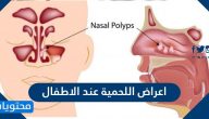 ما هي اعراض اللحمية عند الاطفال وما الحالات التي تستدعي تدخل الطبيب