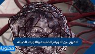 ما هو الفرق بين الاورام الحميدة والاورام الخبيثة