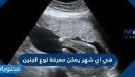 في اي شهر يمكن معرفة نوع الجنين