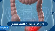 ما هي اعراض سرطان المستقيم وما اسبابه وطرق تشخيصه وعلاجه