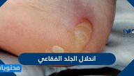 اسباب وطرق علاج انحلال الجلد الفقاعي