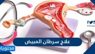 علاج سرطان المبيض