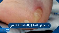 ما مرض انحلال الجلد الفقاعي