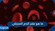 ما هو فقر الدم المنجلي وما انواعه واسبابه وطرق تشخيصه وعلاجه