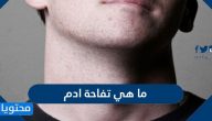ما هي تفاحة ادم وما هي وظيفتها في جسم الانسان