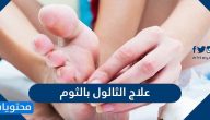 علاج الثالول بالثوم وطرق أخرى لعلاج الثالول