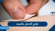 علاج الدمل بالمره .. أسباب وأعراض ظهور الدمامل وطرق الوقاية منها