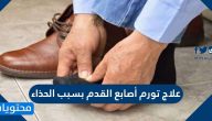 علاج تورم أصابع القدم بسبب الحذاء